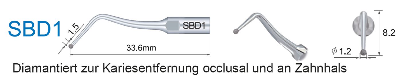 SBD1  Ultraschallspitze diamantiert zur Kariesentfernung okklusal am Zahnhals